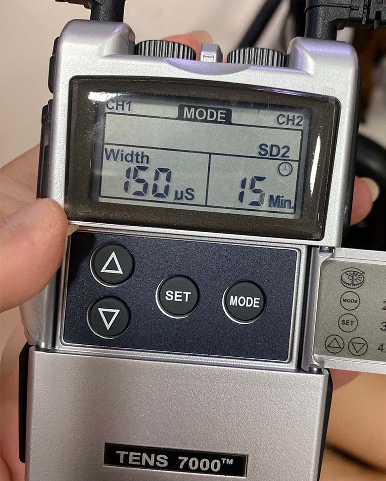 TENS therapy