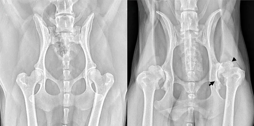 Early Diagnosis of Osteoarthritis